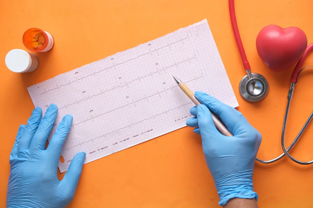 Un électrocardiogramme et un stéthoscope.